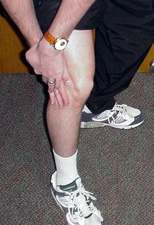 Figure 7 - Lateral knee pain affecting the outside of the knee is sometimes the result of arthritis of the knee.