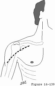 Figure 30
