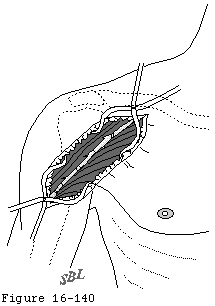 Figure 31