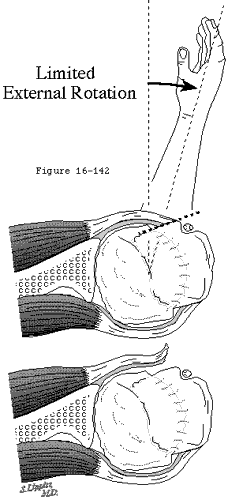Figure 32