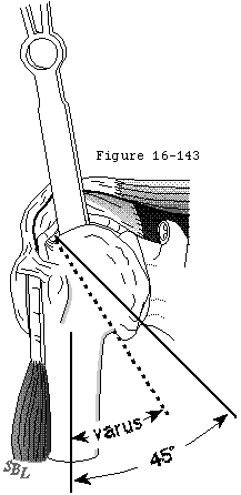 Figure 34