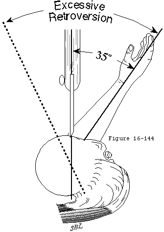Figure 35