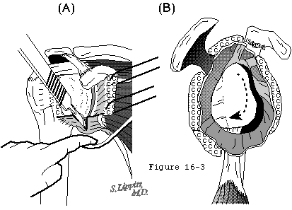Figure 36