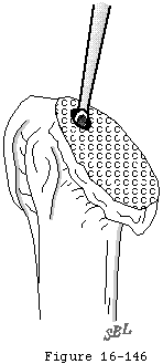 Figure 38