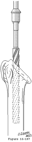 Figure 39