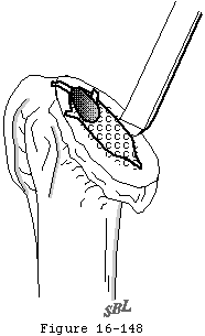 Figure 41