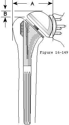 Figure 42