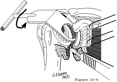 Figure 44