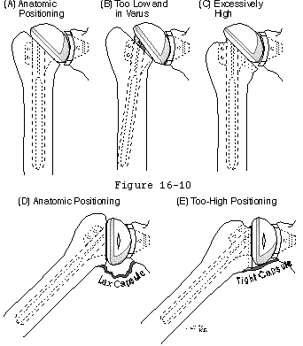 Figure 45