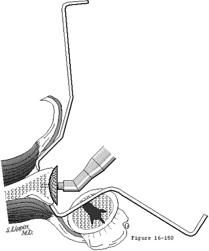 Figure 47