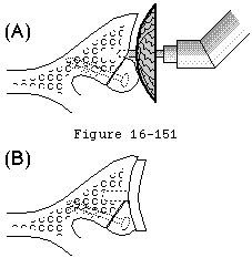 Figure 48