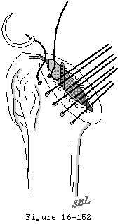 Figure 49