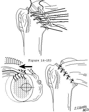 Figure 50