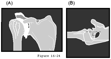 Figure 54