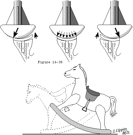 Figure 56