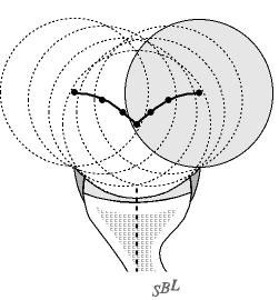 Figure 1 - The concavity of the normal glenoid requires that the humeral head be lifted out of the socket in order to translate