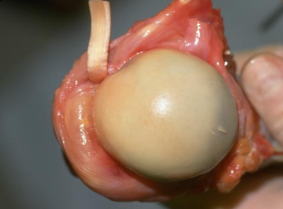 Rotator cuff normal rotator cuff attachment around the humeral head