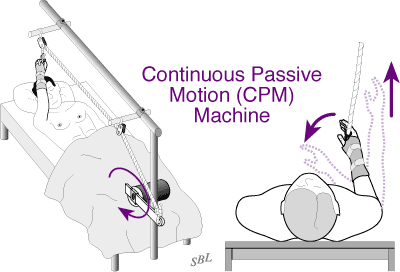 Figure 6 - Continuous passive motion machine