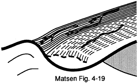 Figure 7 - Limitation of tendon blood flow