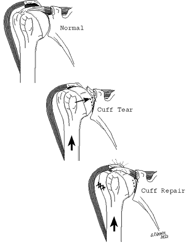 Figure 20