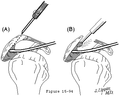 Figure 25