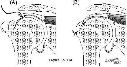 Figure 46