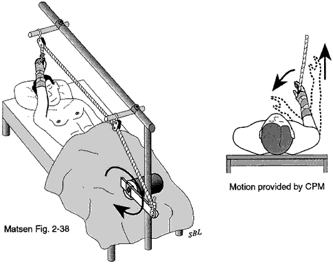 Figure 14 - Continuous passive motion machine