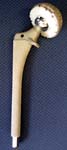 Fig.5 - Typical Hip Replacement Components Hip Arthritis - Typical hip replacement components.