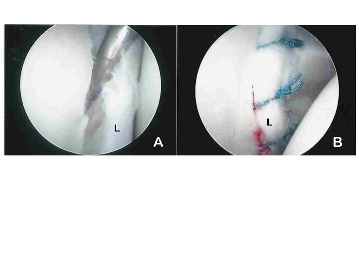 Figure 7a & 7b