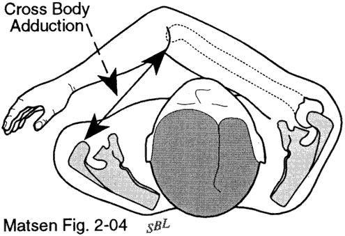 Figure 4 - Cross body