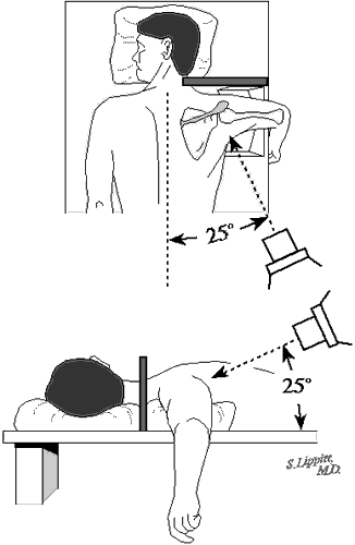 Figure 20