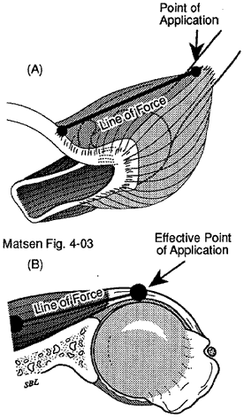 Figure 3 - The points of application of a muscle force are not necessarily the same as that muscle's