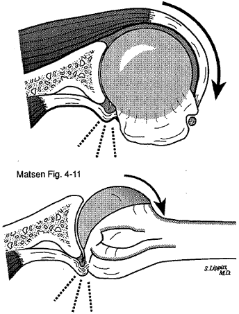 Figure 11 - The glenoid rim abuts against the deep surface of the tendon insertion