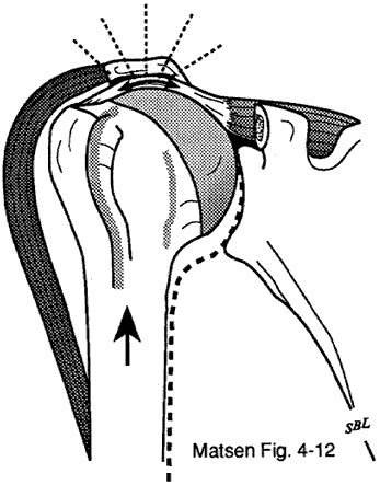 Figure 13 - Coracoacromial arch