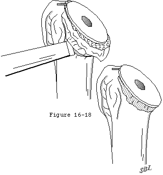 Figure 16