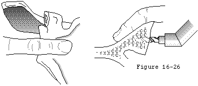 Figure 27