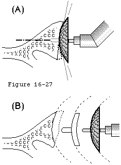 Figure 28
