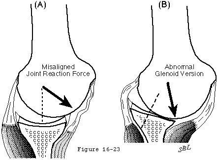 Figure 30