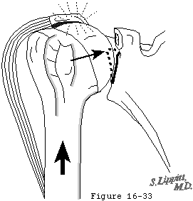 Figure 36