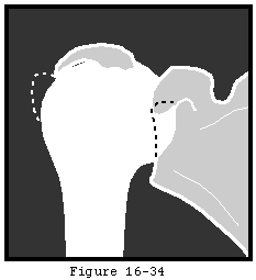 Figure 37