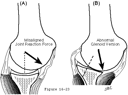 Figure 23