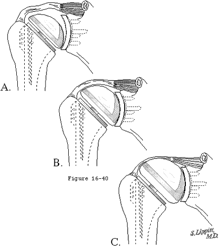 Figure 43